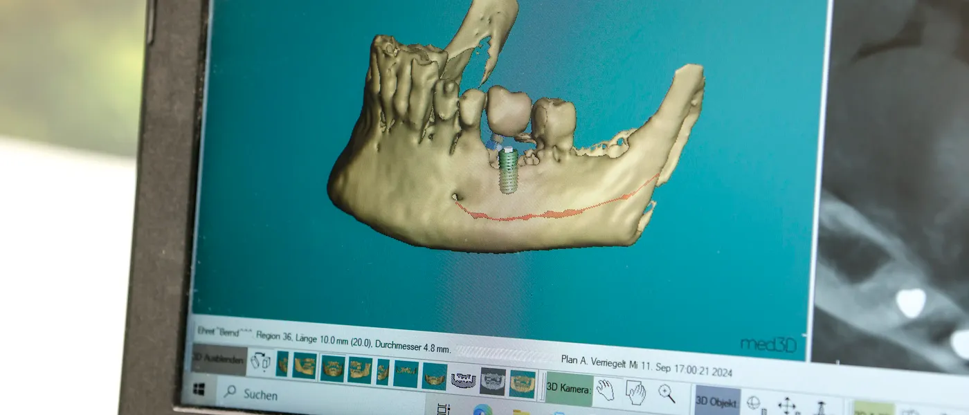 Dentallabor Mandel in Frankenthal